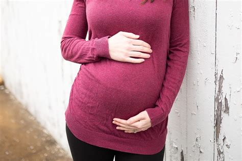 varice vaginale în timpul fotografiei sarcinii